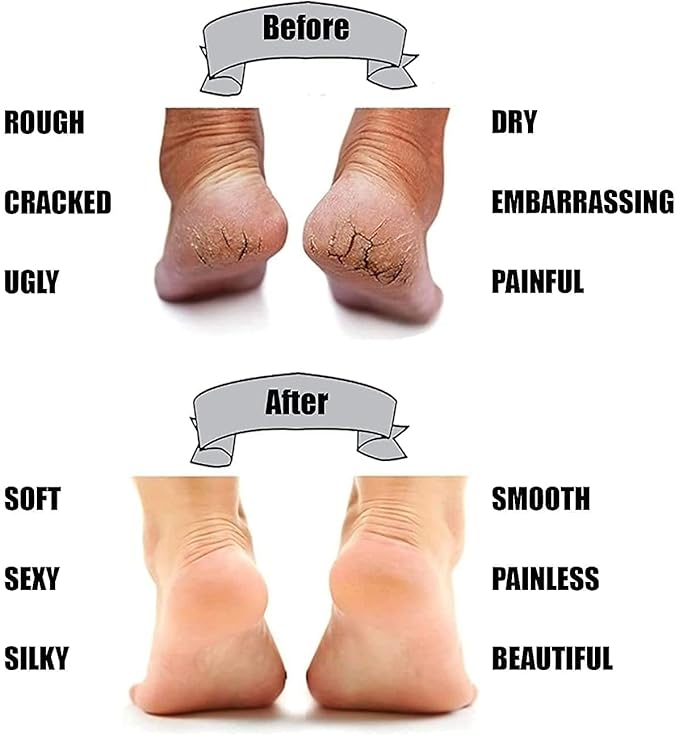 ToyZone™ Anti Foot Crack